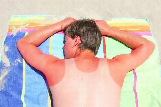 Baking staple sitting in your cupboard can soothe sunburn ‘almost instantly’